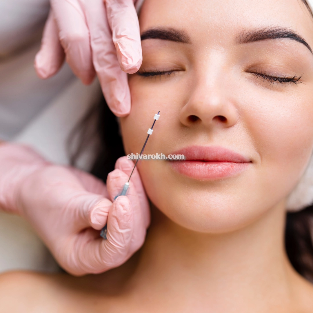 لیفت شقیقه برای رفع افتادگی چشم در تهران