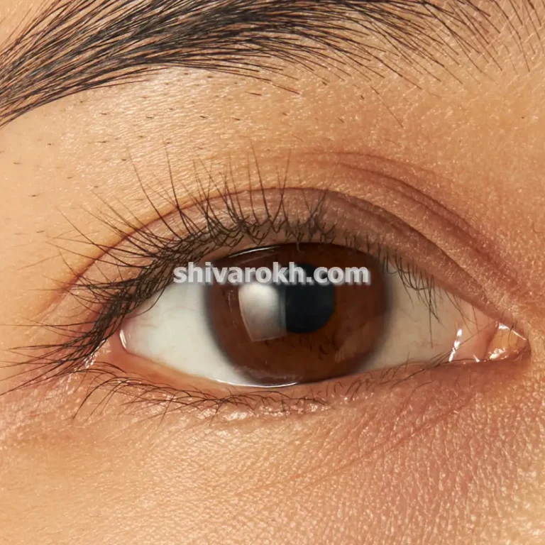 کاشت مژه طبیعی در تهران نیاوران